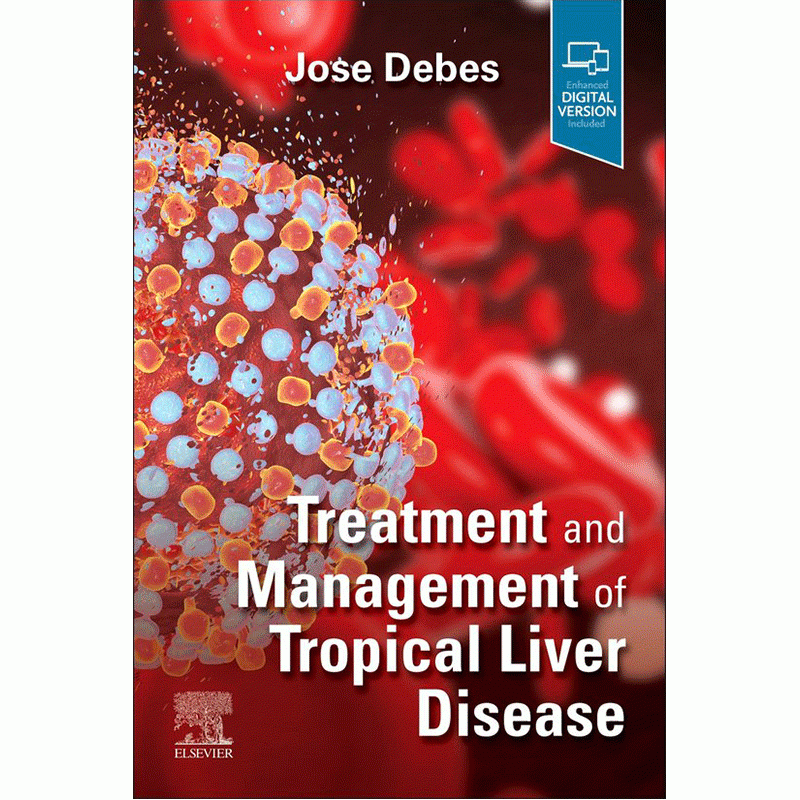 Treatment and Management of Tropical Liver Disease