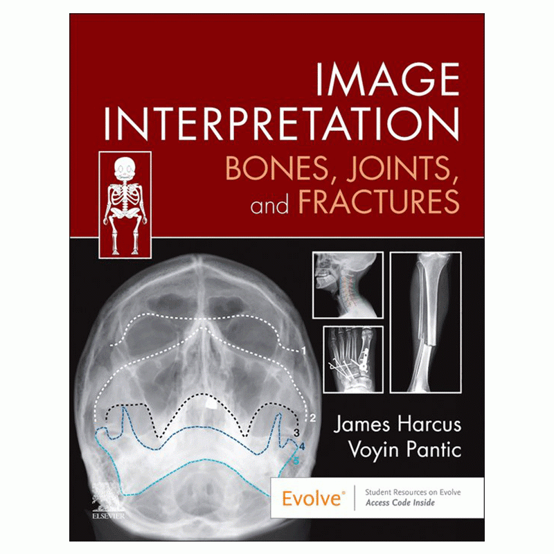 Image Interpretation: Bones, Joints, and Fractures, 1η Έκδοση