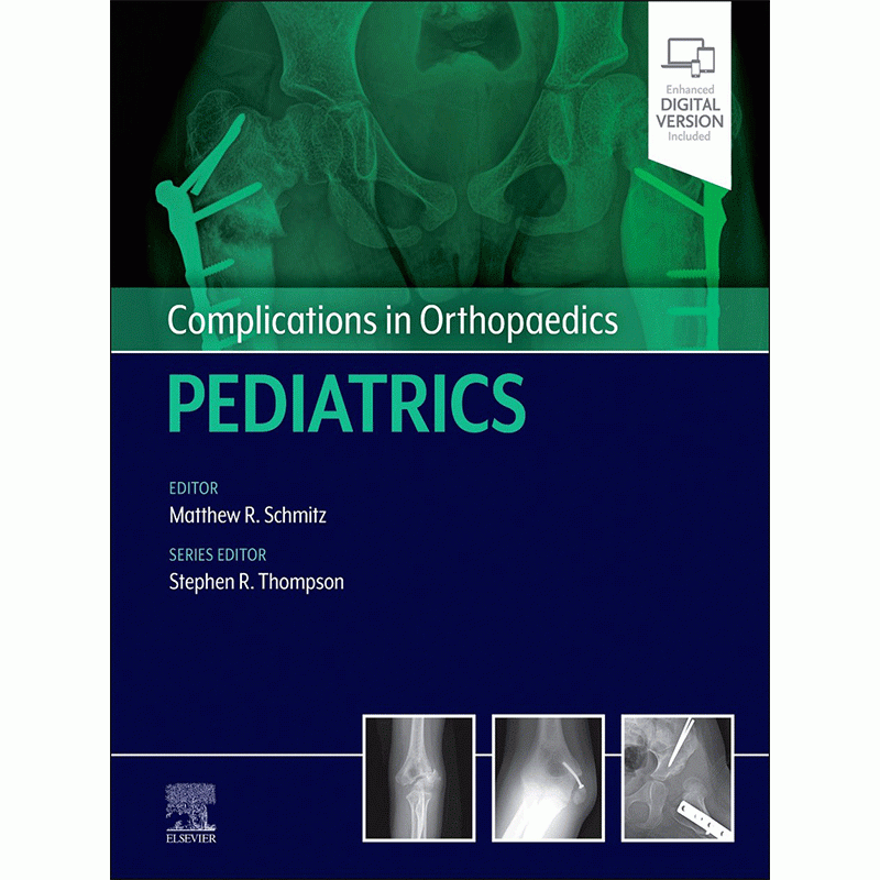 Complications in Orthopaedics: Pediatrics