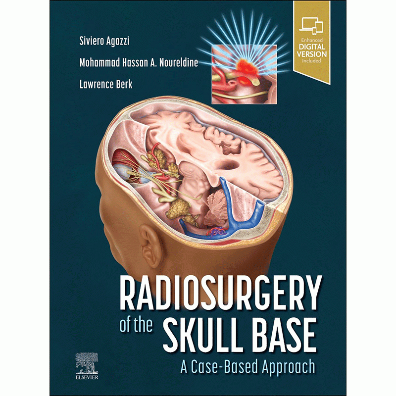 Radiosurgery of the Skull Base: A Case-Based Approach