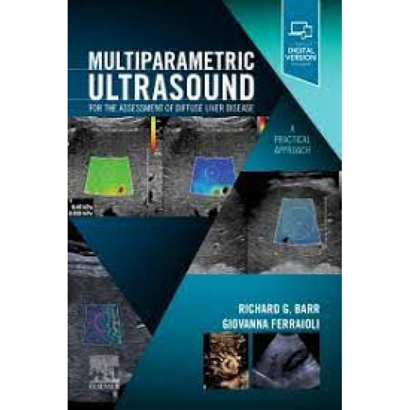 Multiparametric Ultrasound for the Assessment of Diffuse Liver Disease A Practical Approach