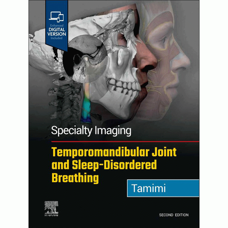 Specialty Imaging: Temporomandibular Joint and Sleep-Disordered Breathing, 2nd Edition