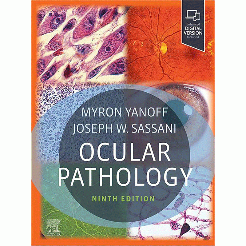 Ocular Pathology, 9th Edition