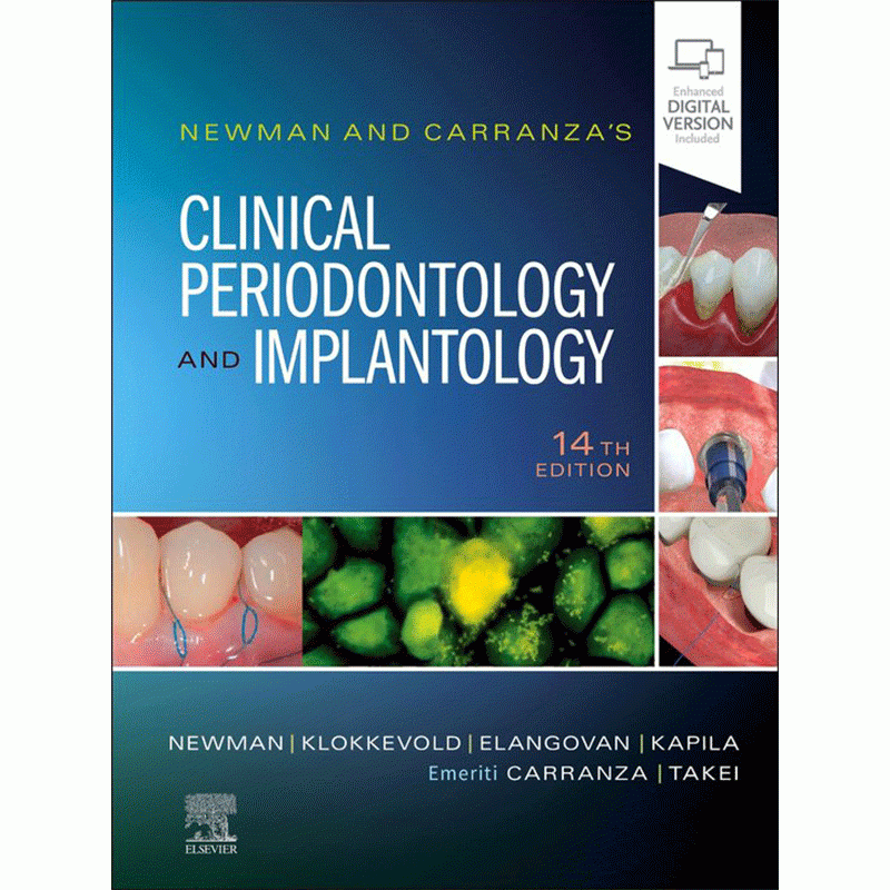 Newman and Carranza’s Clinical Periodontology and Implantology, 14th Edition