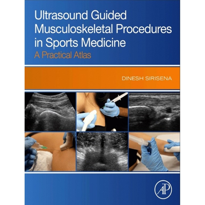 Ultrasound Guided Musculoskeletal Procedures in Sports Medicine: A Practical Atlas