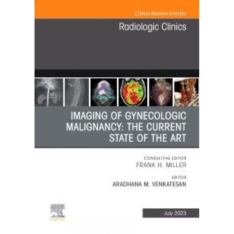 Imaging of Gynecologic Malignancy: The Current State of the Art, An Issue of Radiologic Clinics of North America, 1st Edition