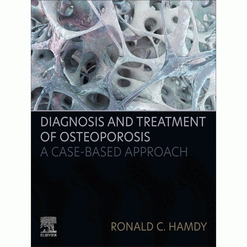 Diagnosis and Treatment of Osteoporosis: A Case-Based Approach