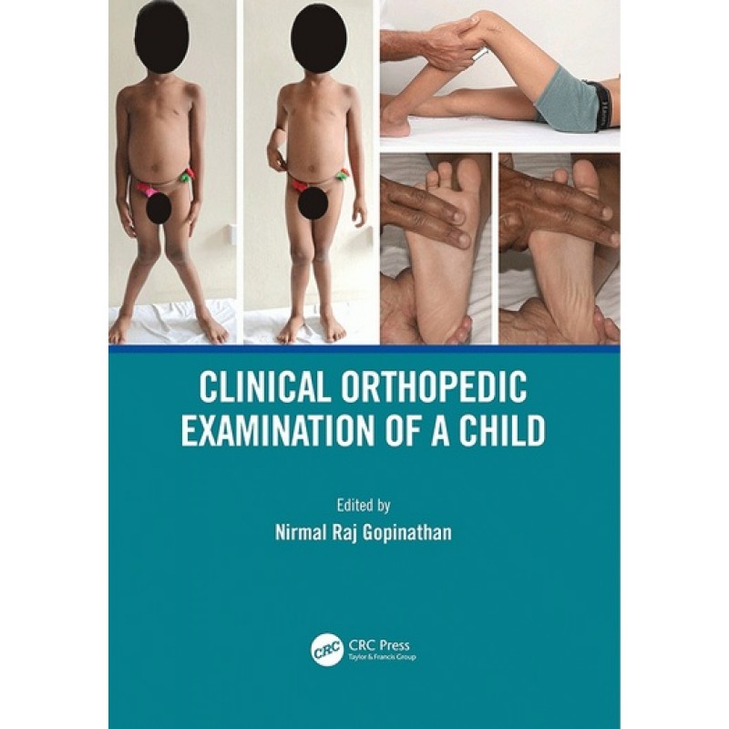 Clinical Orthopedic Examination of a Child 