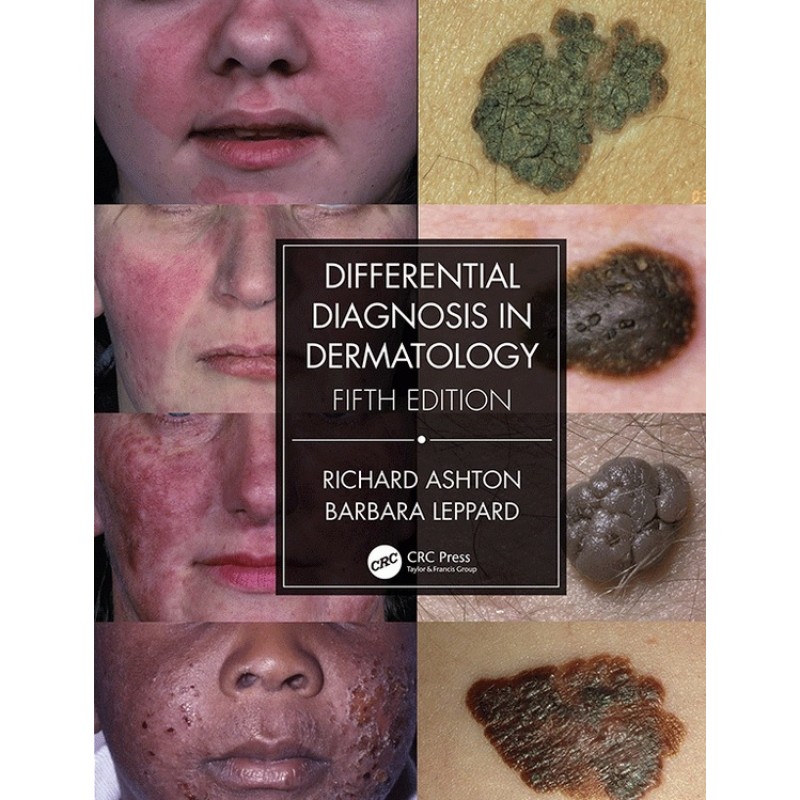 Differential Diagnosis in Dermatology 5E