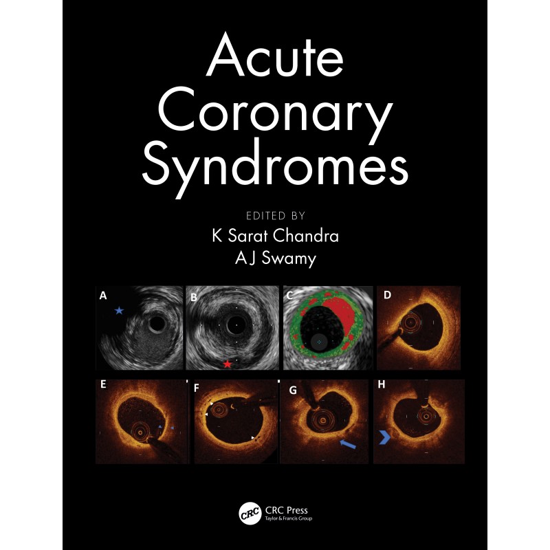 Acute Coronary Syndromes 1st Edition