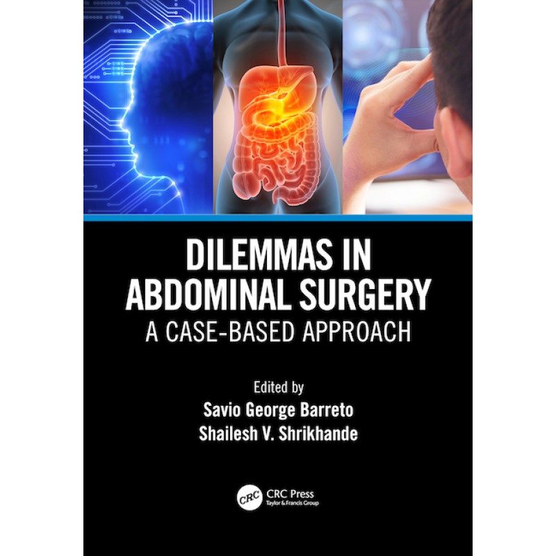 Dilemmas in Abdominal Surgery, A Case-Based Approach 1E