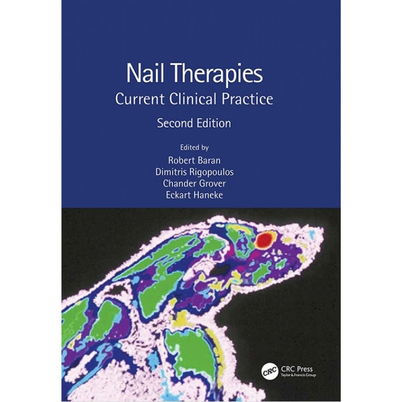 Nail Therapies Current Clinical Practice 2E