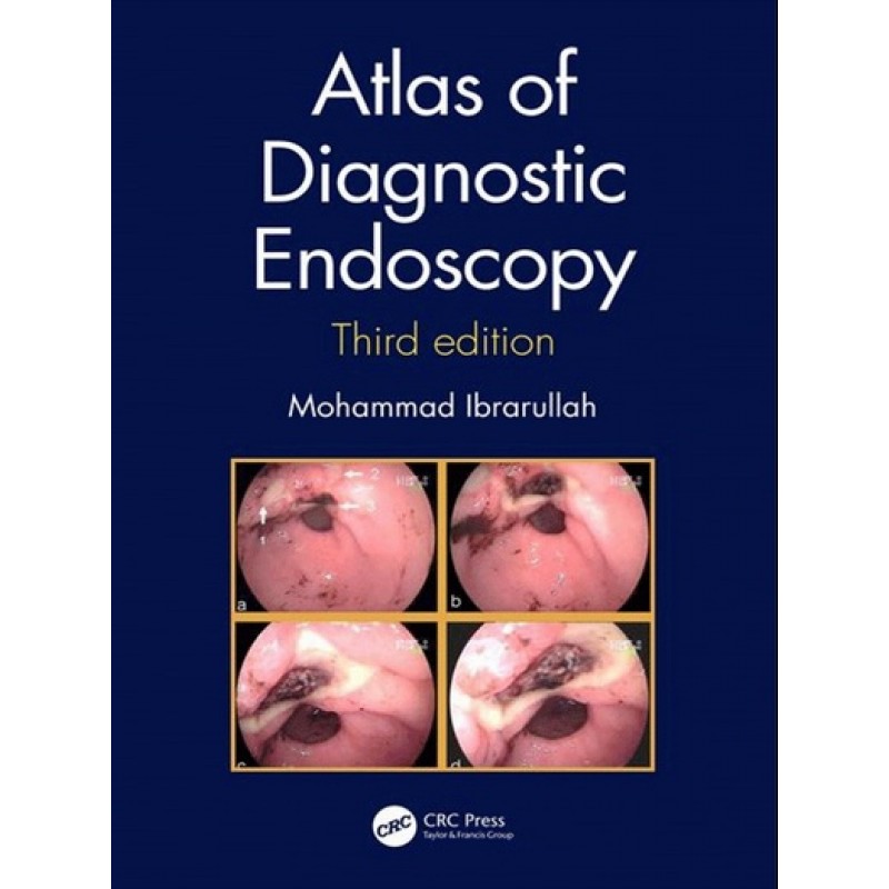 Atlas of Diagnostic Endoscopy, 3E 