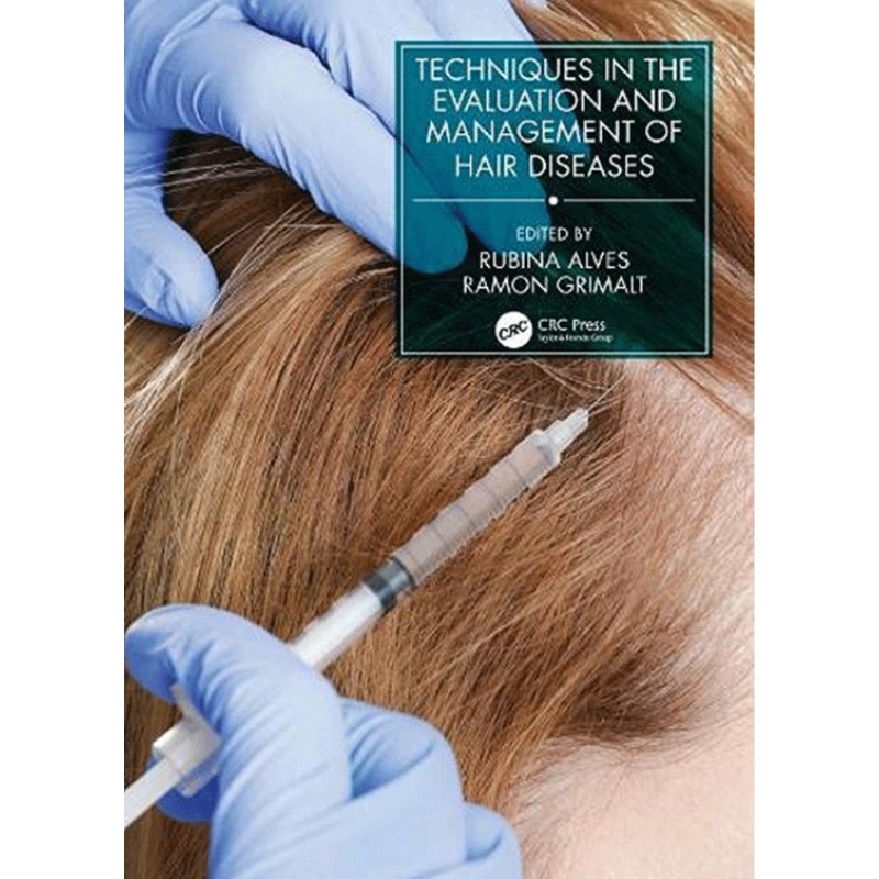 Techniques in the Evaluation and Management of Hair Diseases 