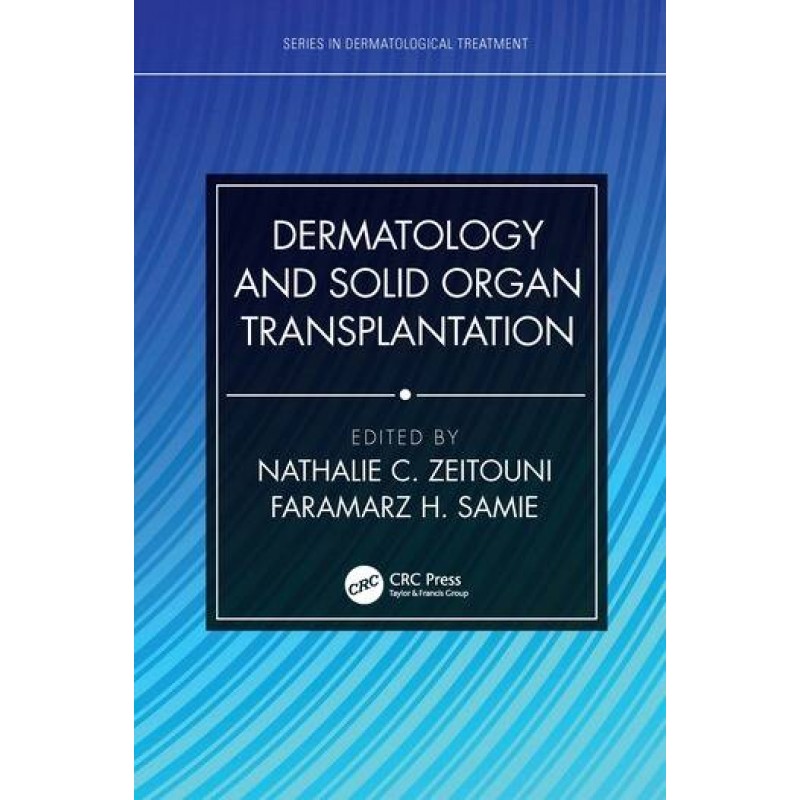 Dermatology and Solid Organ Transplantation 1st Edition