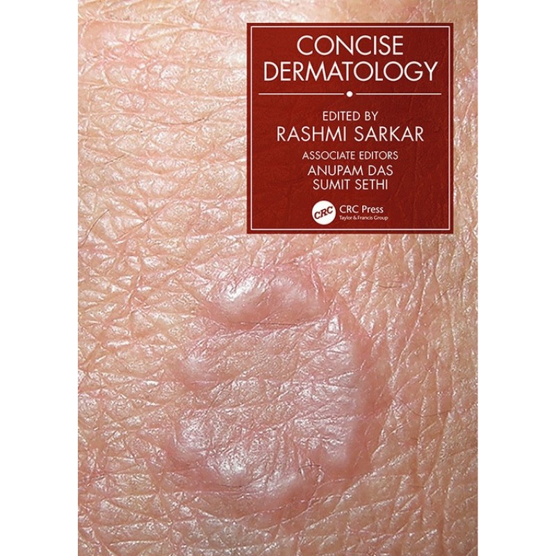 Concise Dermatology 