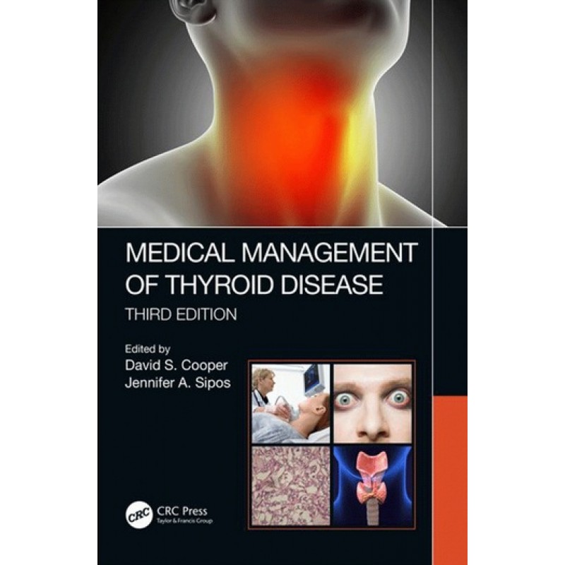 Medical Management of Thyroid Disease 3E