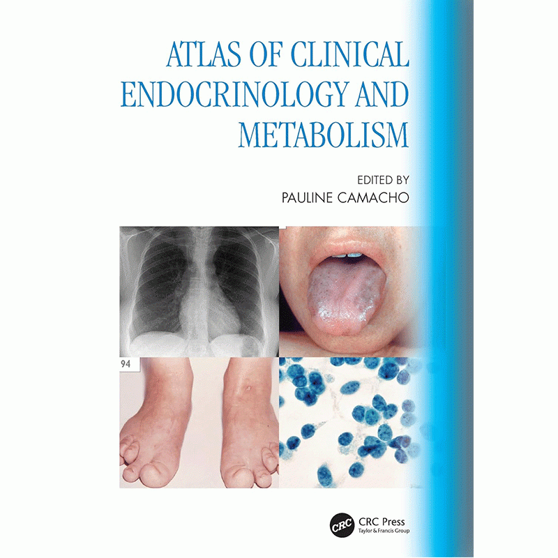 Atlas of Clinical Endocrinology and Metabolism