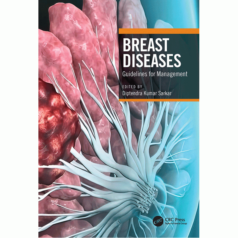 Breast Diseases: Guidelines for Management