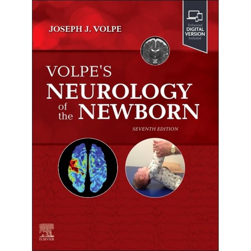 Volpe's Neurology of the Newborn 7th Edition