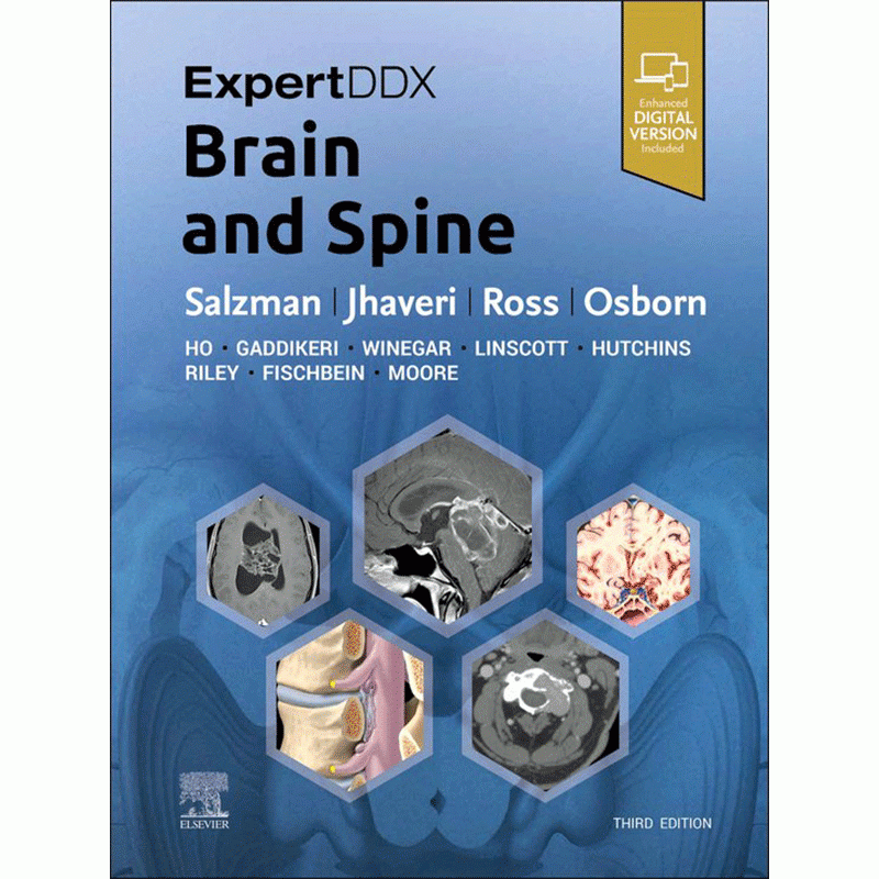 ExpertDDx: Brain and Spine, 3rd Edition