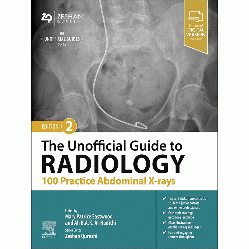 The Unofficial Guide to Radiology: 100 Practice Abdominal X-rays, 2nd Edition