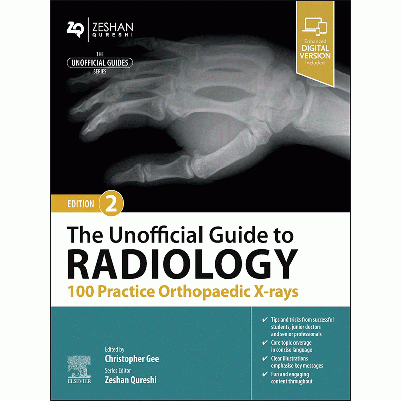 The Unofficial Guide to Radiology: 100 Practice Orthopaedic X-rays, 2nd Edition