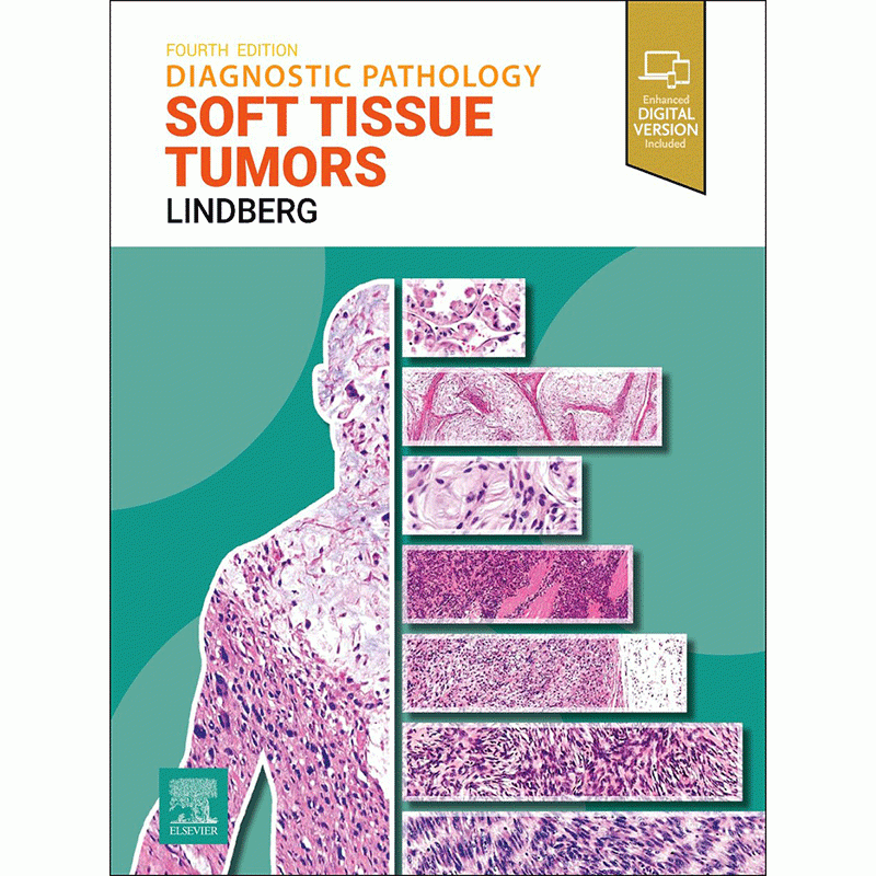 Diagnostic Pathology: Soft Tissue Tumors, 4th Edition