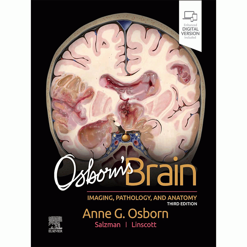 Osborn’s Brain: Imaging, Pathology and Anatomy, 3rd Edition