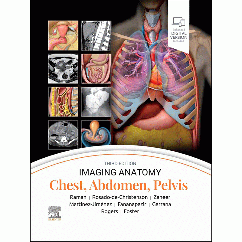 Imaging Anatomy: Chest, Abdomen, Pelvis, 3rd Edition