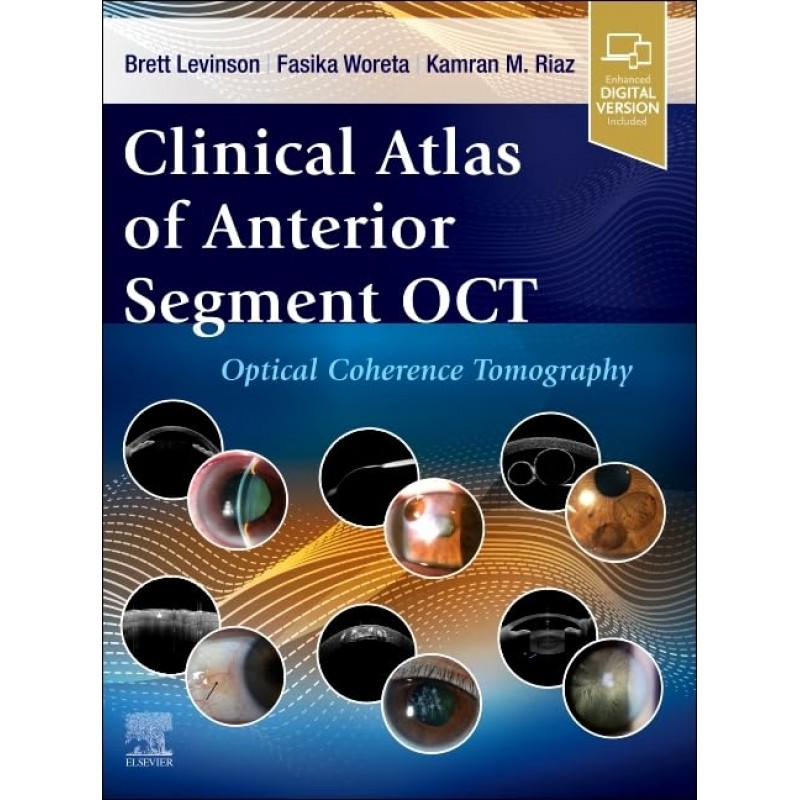 Clinical Atlas of Anterior Segment OCT: Optical Coherence Tomography, 1st Edition