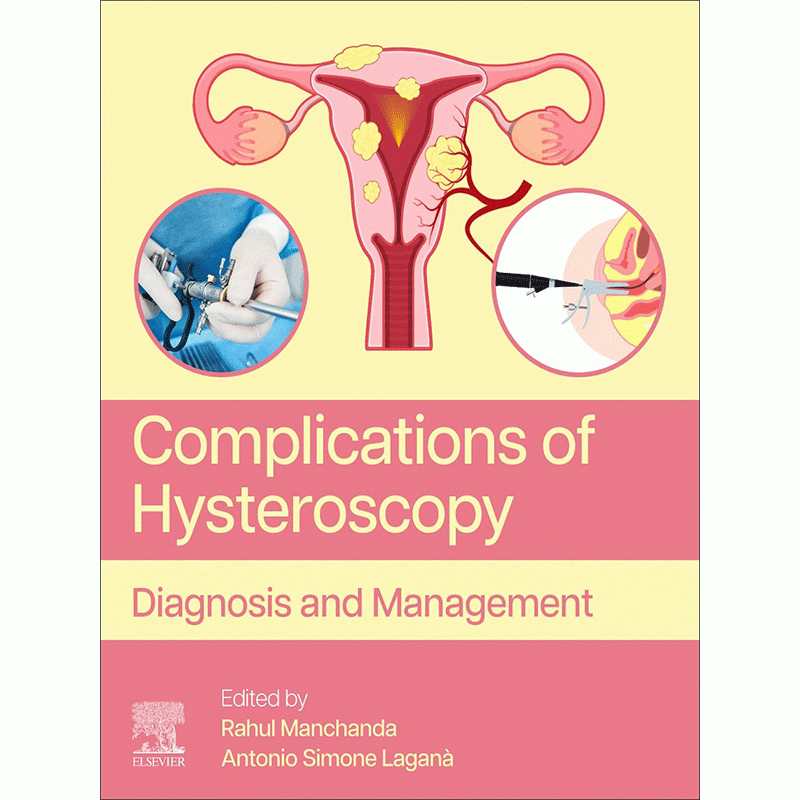 Complications of Hysteroscopy: Diagnosis and Management