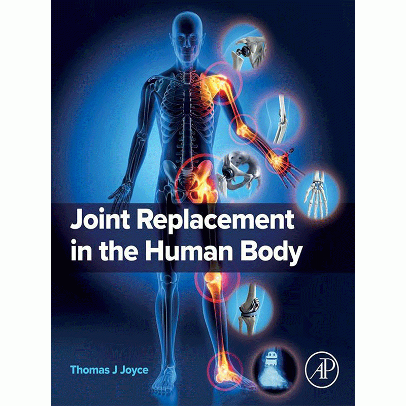 Joint Replacement in the Human Body