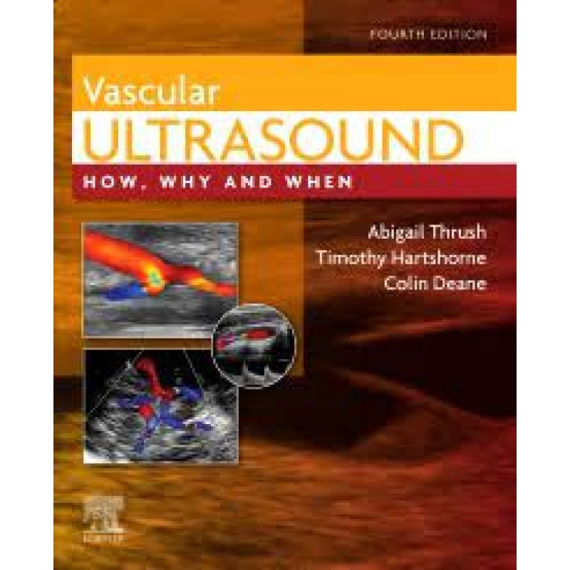 Vascular Ultrasound, 4E, How, Why and When