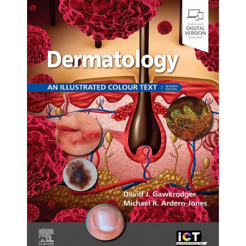 Dermatology 7E: An Illustrated Colour Text