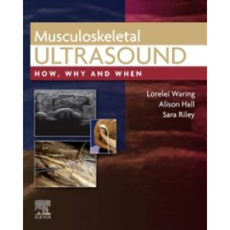 Musculoskeletal Ultrasound: How, Why and When