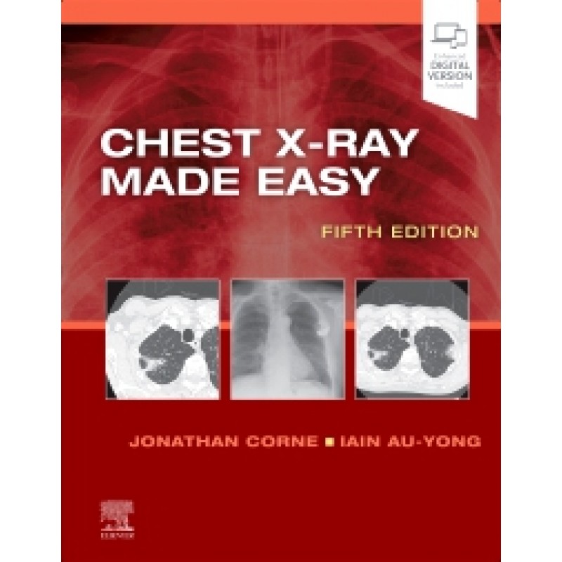 Chest X-Ray Made Easy, 5E 