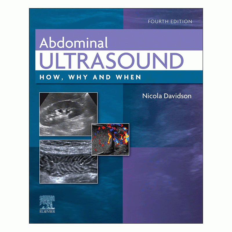 Abdominal Ultrasound: How, Why and When, 4th Edition