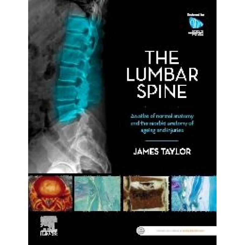 The Lumbar Spine An Atlas of Normal Anatomy and the Morbid Anatomy of Ageing and Injury 