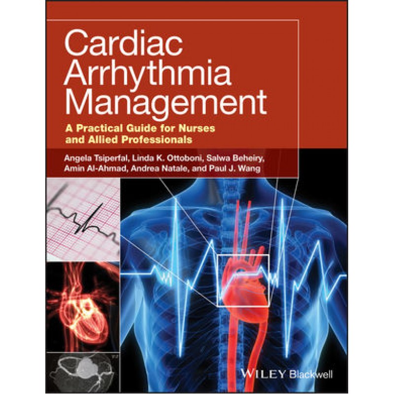 Cardiac Arrhythmia Management: A Practical Guide for Nurses and Allied Professionals