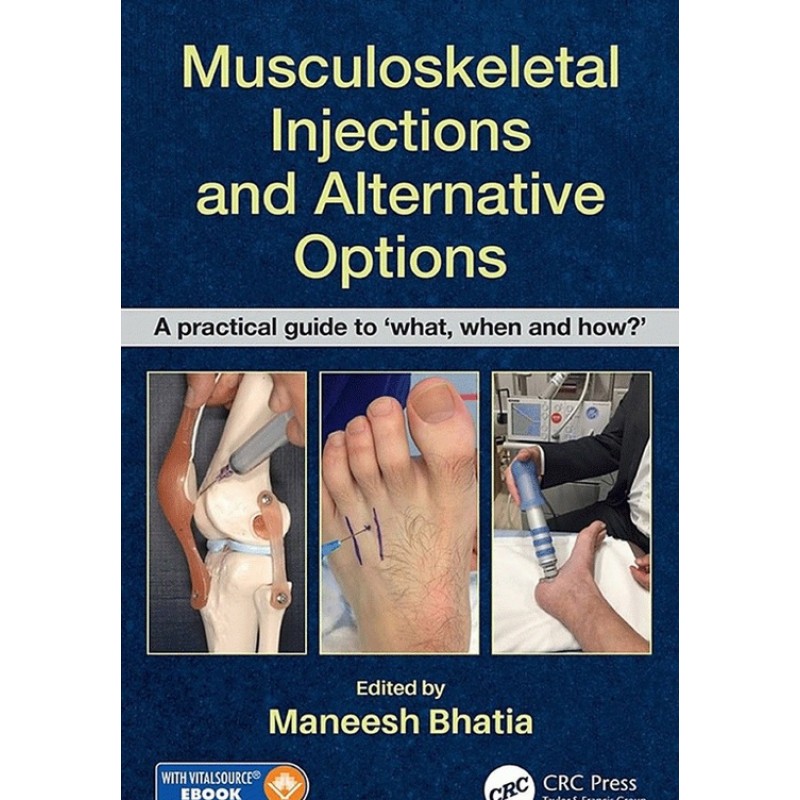 Musculoskeletal Injections and Alternative Options A practical guide to 'what, when and how?'