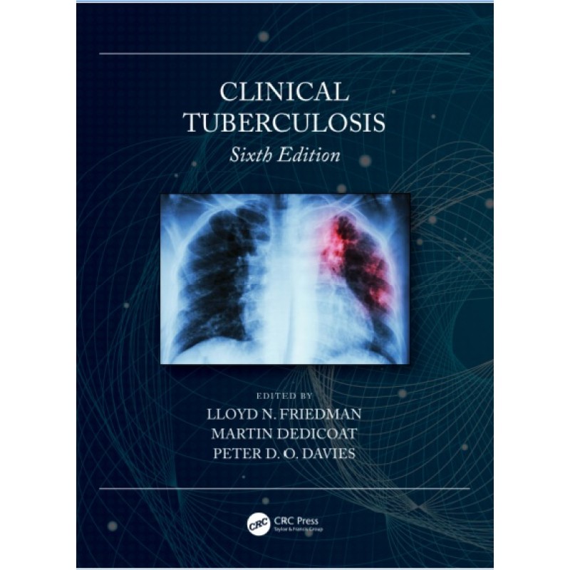 Clinical Tuberculosis 6th Edition