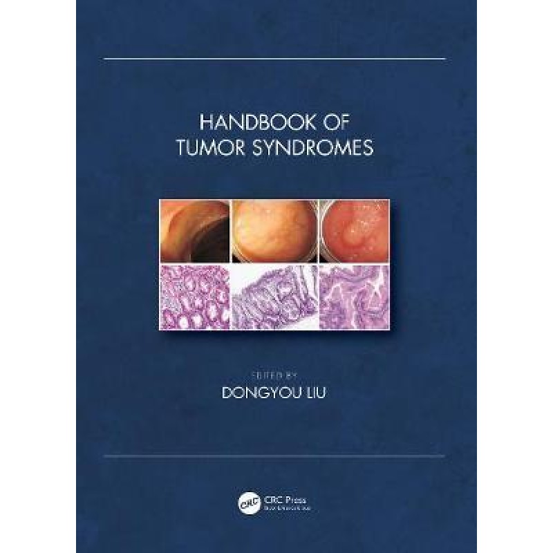 Handbook of Tumor Syndromes 