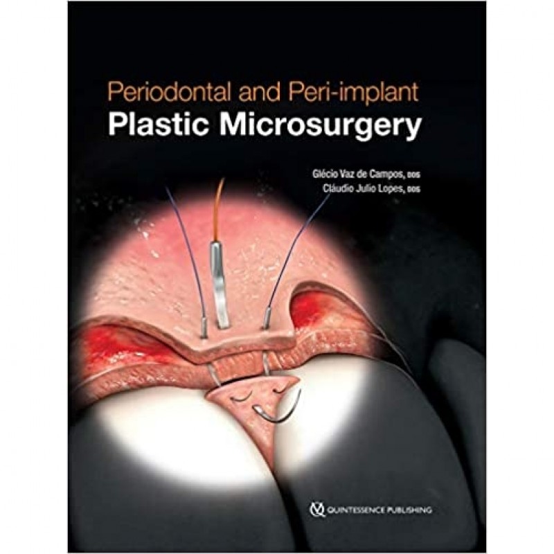 Periodontal and Peri-implant Plastic Microsurgery: Minimally Invasive Techniques with Maximum Precision