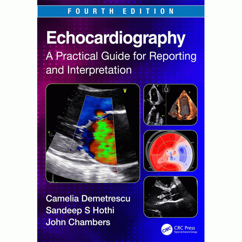 Echocardiography: A Practical Guide for Reporting and Interpretation, 4th Edition