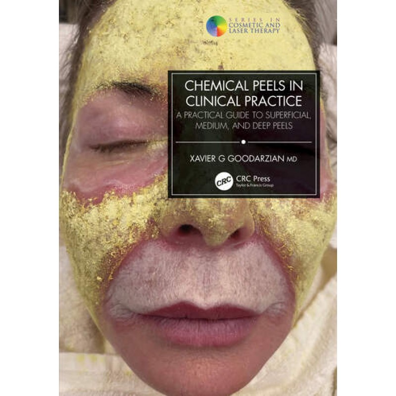 Chemical Peels in Clinical Practice: A Practical Guide to Superficial, Medium, and Deep Peels, 1st Edition