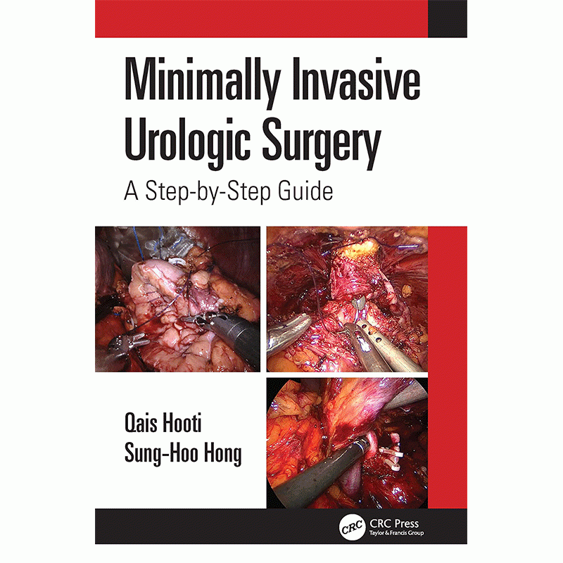 Minimally Invasive Urologic Surgery: A Step-by-Step Guide