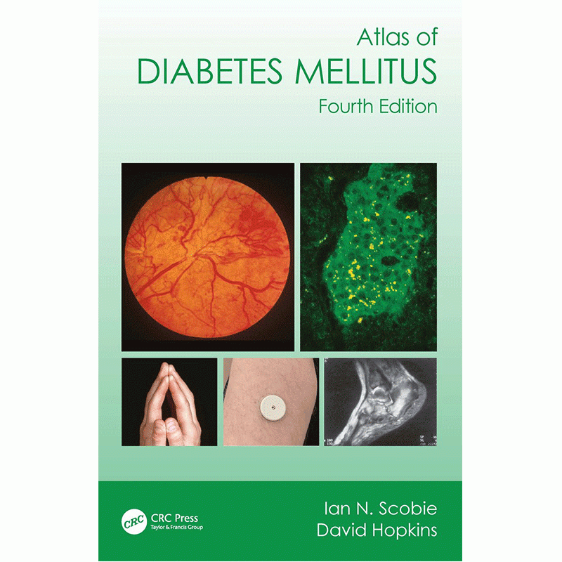 Atlas of Diabetes Mellitus, 4th Edition