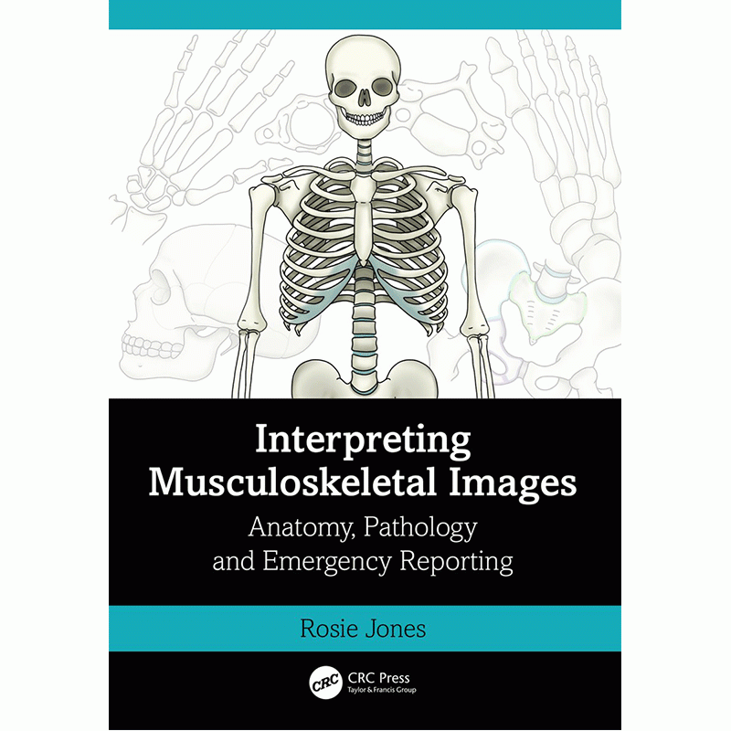 Interpreting Musculoskeletal Images: Anatomy, Pathology and Emergency Reporting