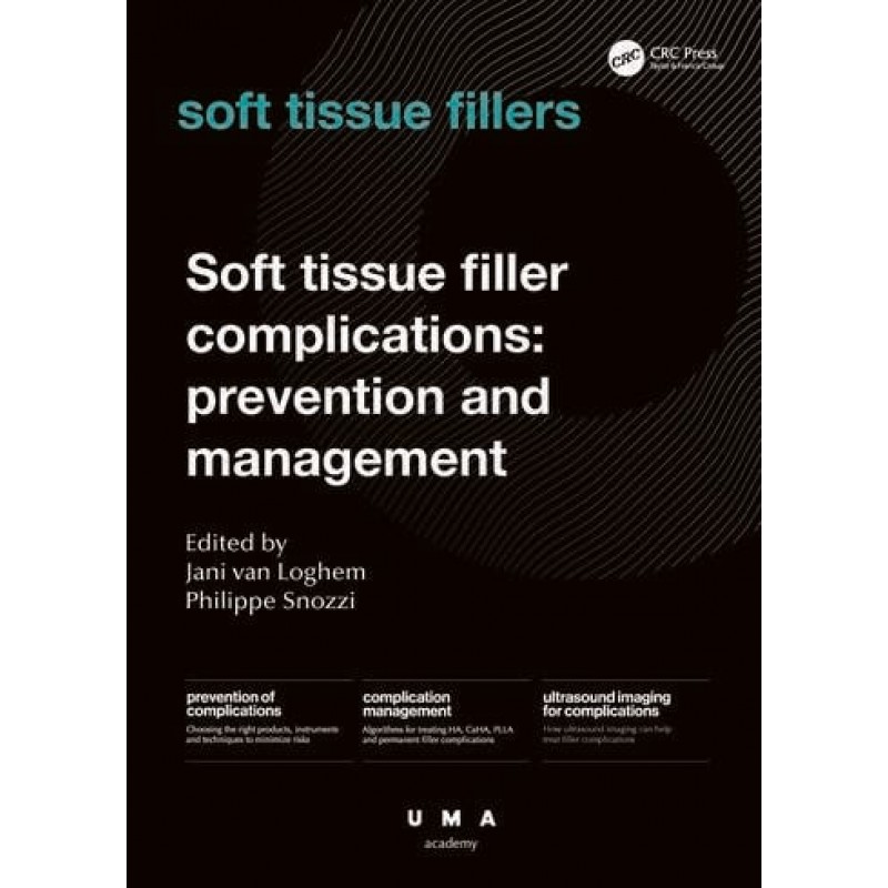 Soft Tissue Filler Complications: Prevention and Management, 1st Edition